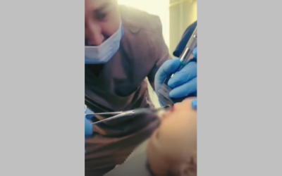 Годовалый ребенок проглотил 4-сантиметровый болт